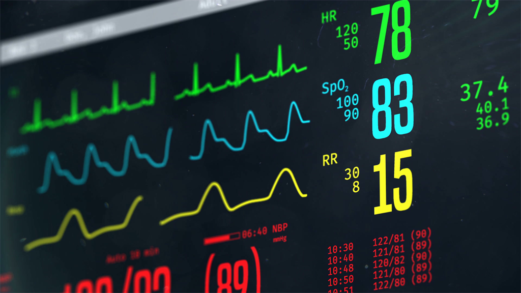 Cardiac monitor